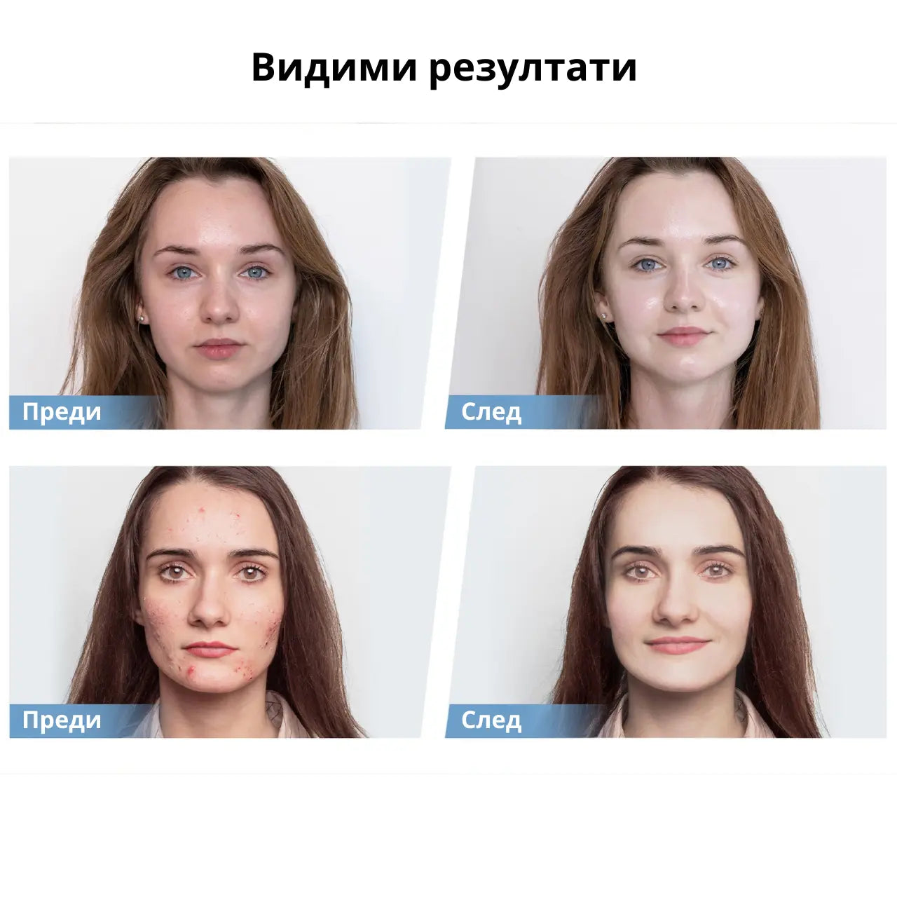 Hydra.Pen H5 Dr. Pen – писалка с EMS и апликатор за серум