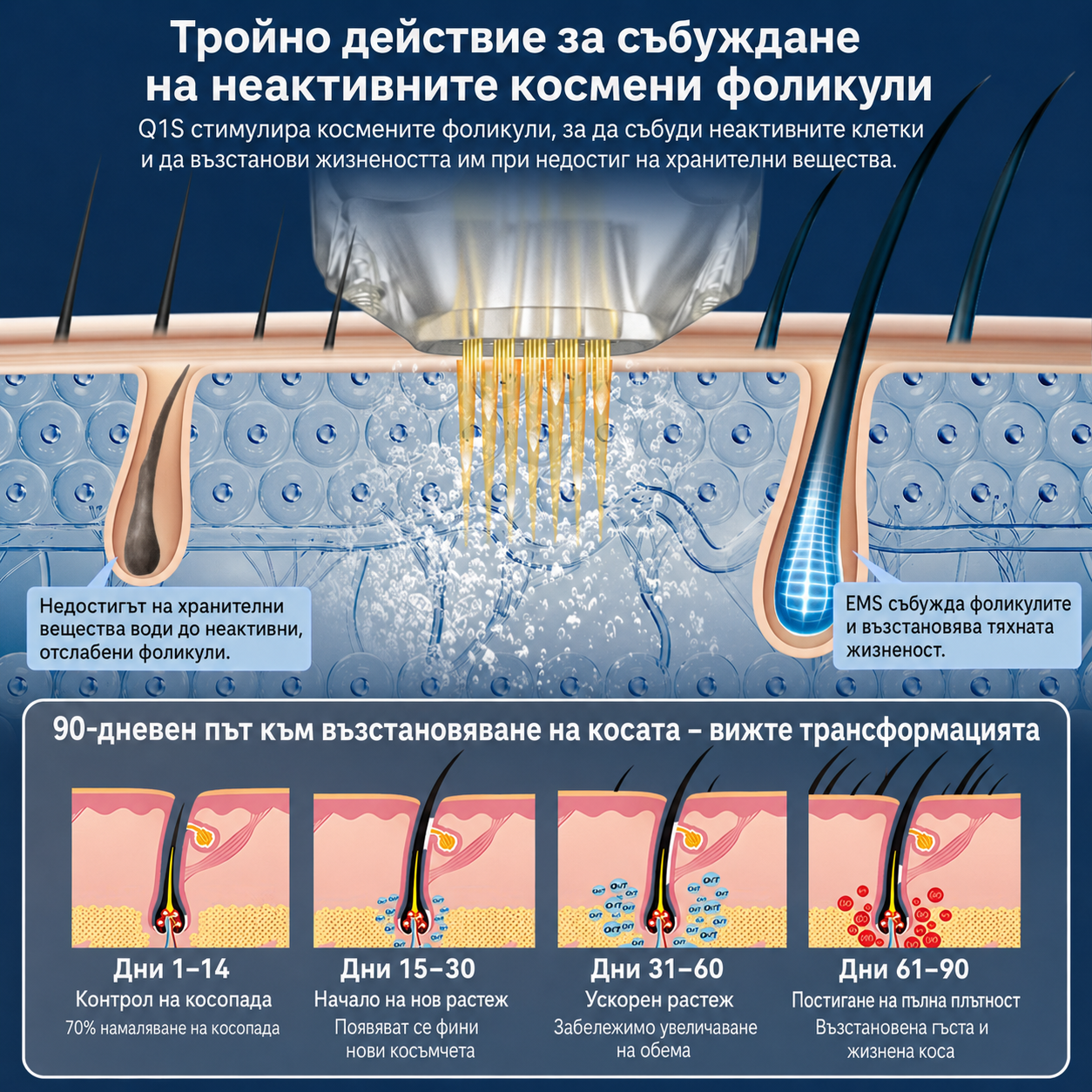 Dr. Pen Q1S – микронидлинг писалка с EMS, LED и електропорация