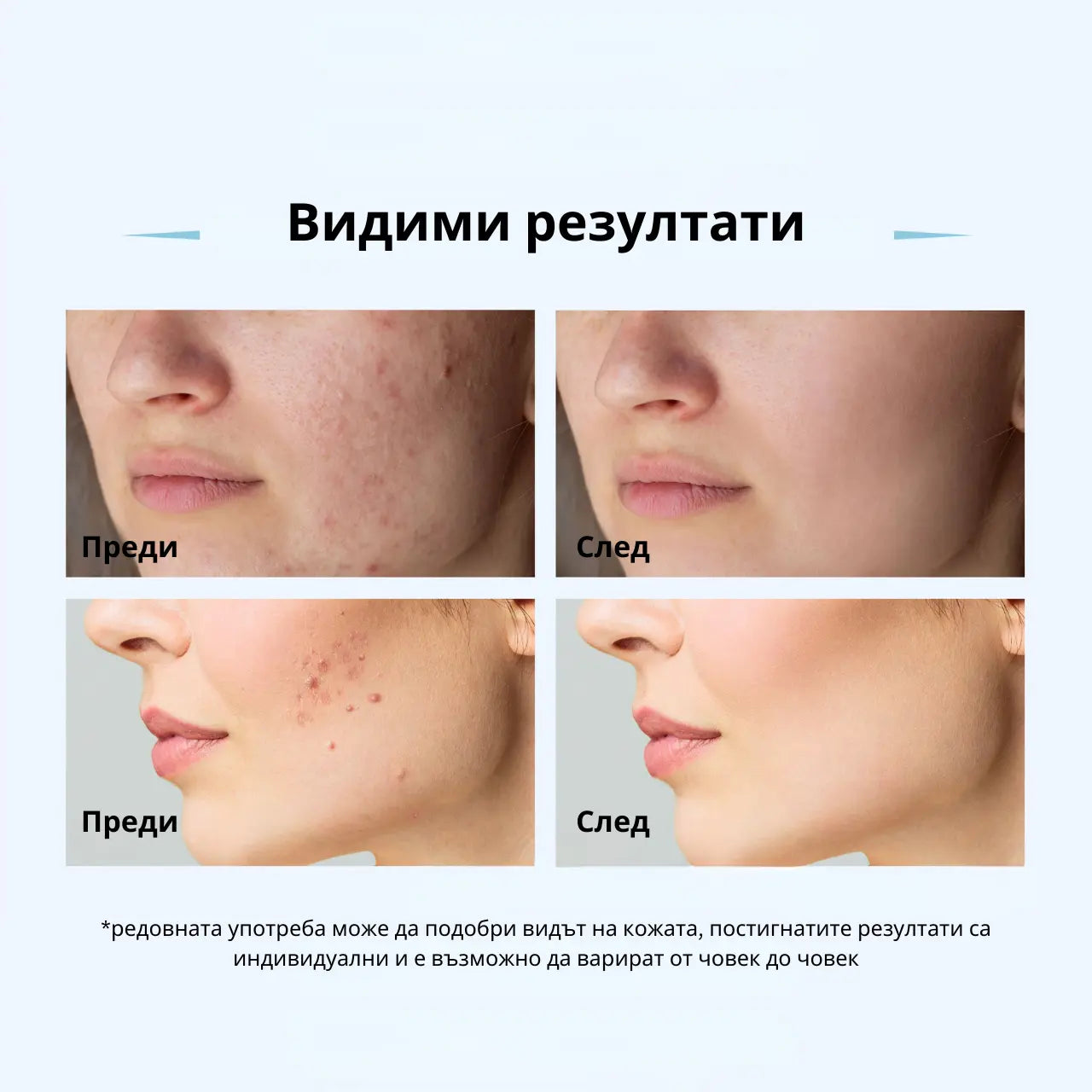 Dr.Pen A11 Ultima PRO прецизен микронидлинг