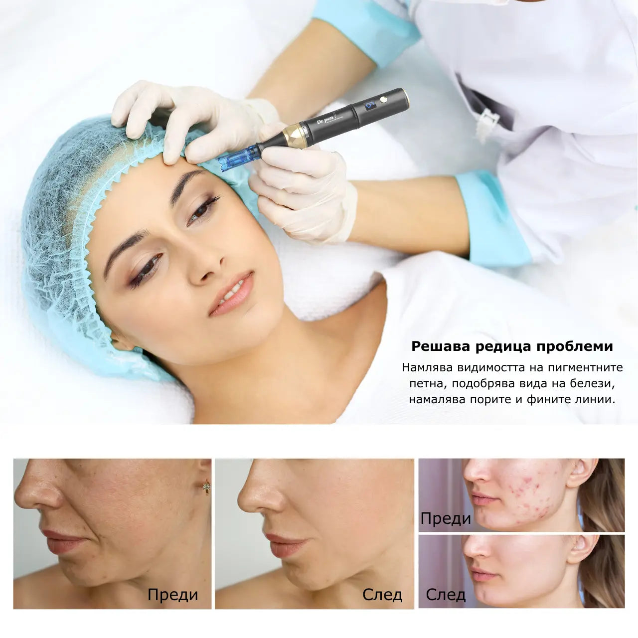Дермапен Dr. Pen A8S – професионален микронидлинг уред